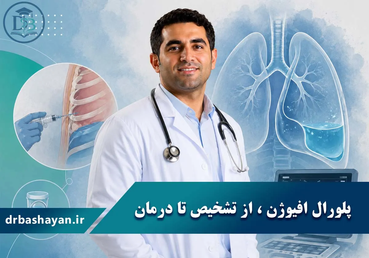 Effusion: From Diagnosis to Treatment